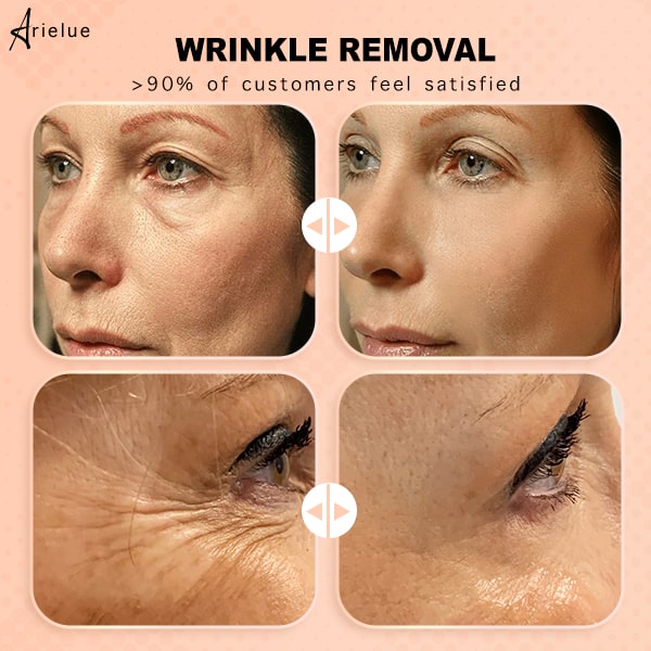 Arielue™ I Anti-Wrinkle Skin Rebounce Moisturizing Balm | 1+1 free - Justsis